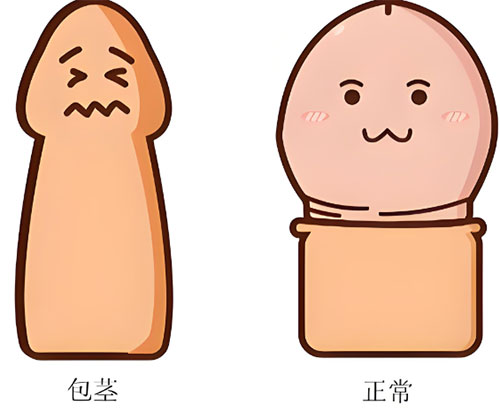 <b>包茎不割会有什么影响</b>