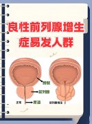 总是想尿、尿完仍有尿意还疼，到底是怎么回事？