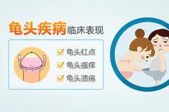 包皮发炎只用水洗没用？乱涂洗液越治越重，正确处理方法收好