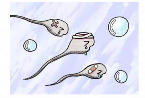 <b>死精症表现有哪些</b>