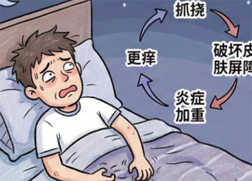<b>阴囊瘙痒是什么病</b>