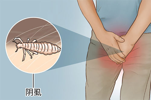 <b>男人阴虱是怎么生长出来的</b>