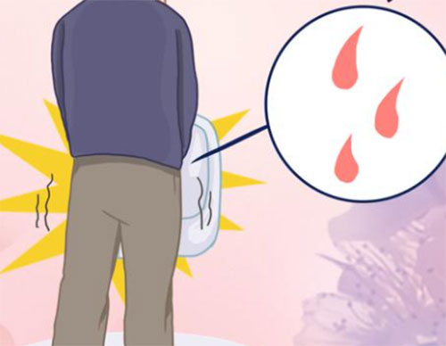 <b>男人尿血是啥原因</b>