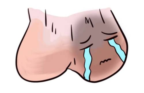 <b>睾丸炎症状有哪些表现</b>