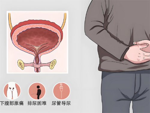 <b>男人尿潴留是什么原因</b>