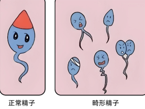 <b>畸形精症可以正常受孕吗</b>