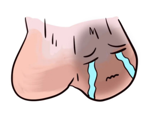 <b>睾丸痛做什么检查</b>