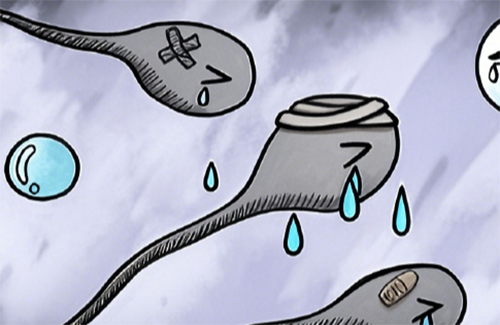<b>男人死精的原因有哪些</b>