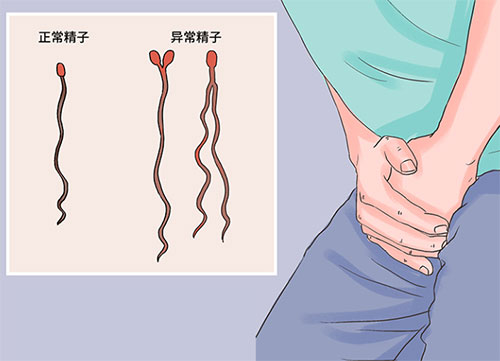 <b>男人精液畸形率多少正常</b>